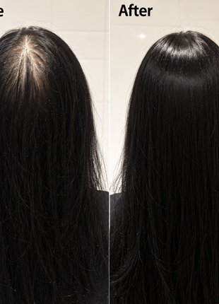 Postpartum hairfall Natural Regrowth Shampoo and Conditioner| Scientifically Proven Chinese Traditional Special Formula for New Mothers|