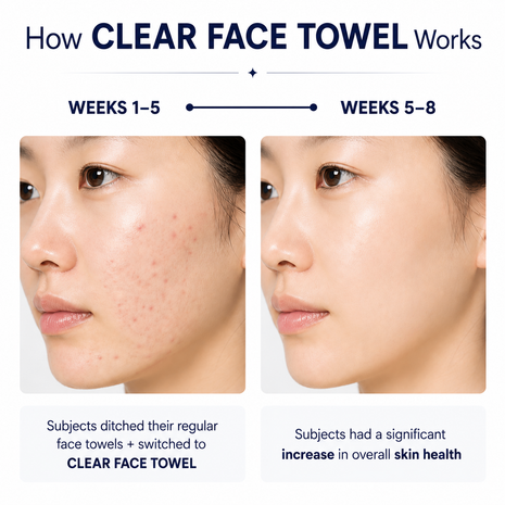 Disposable Face Towels XL,Acne Fighting Biodegradable Face Towel, Ultra Soft for Sensitive Skin, Eco-Friendly Facial Towels for Cleansing & Drying